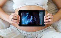 Razlozi izvođenja ultrazvučnih pregleda u trudnoći